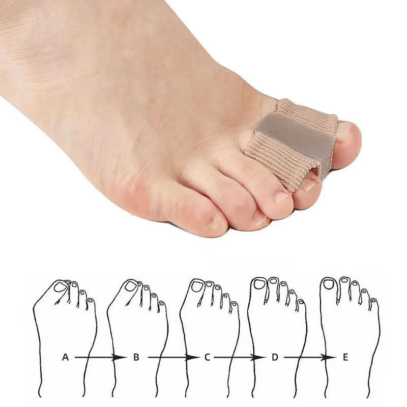 Fiber Toe Separator for Ultimate Comfort and Alignment - ShopLaredo