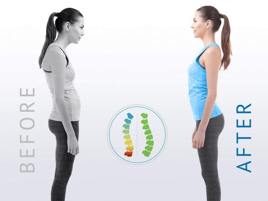 Posture Corrector - ShopLaredo